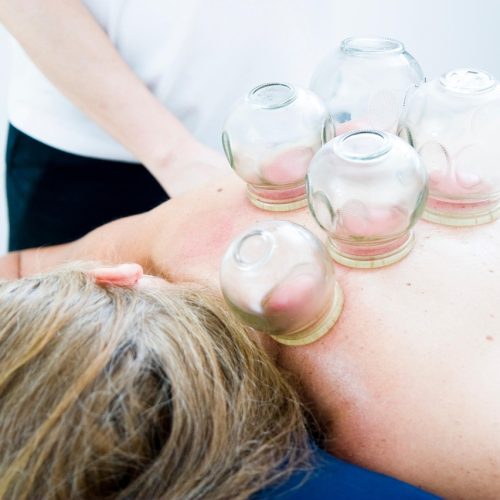 cupping therapy, cupping massage, massage, alternative medicine, chinese traditional medicine, cupping therapy, cupping therapy, cupping therapy, cupping therapy, cupping therapy